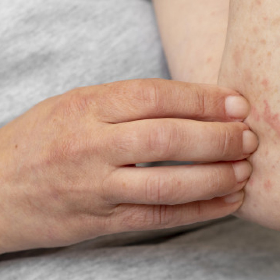 Reaccinurticaria
