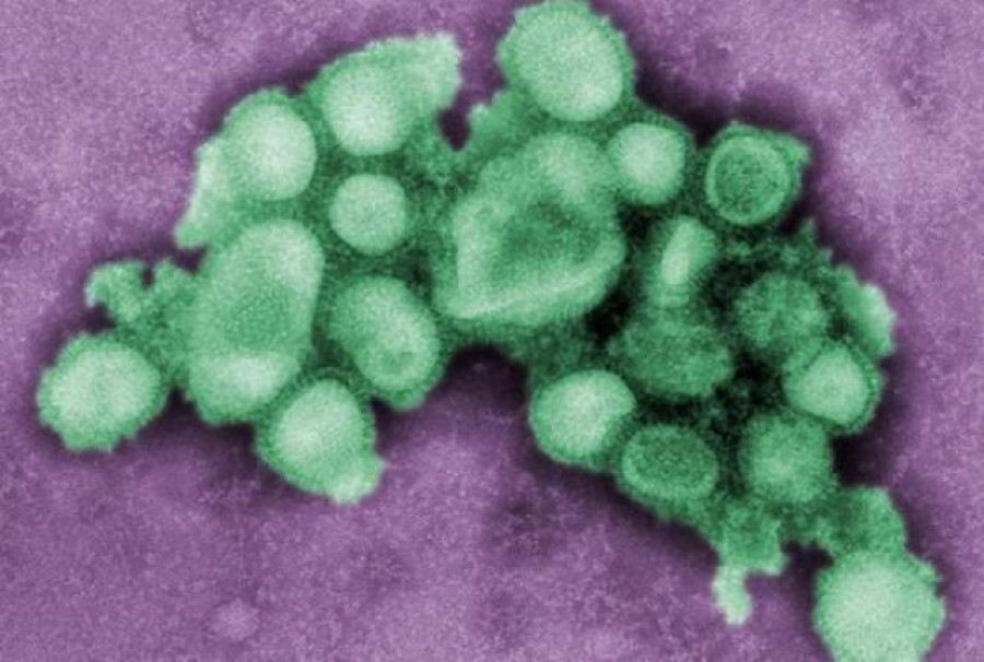 Elaboran un nuevo plan para la OMS para afrontar futuras pandemias de gripe