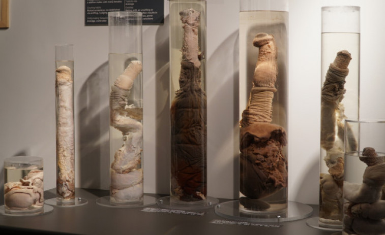 La Faloteca Nacional de Islandia, el museo de penes más completo del mundo