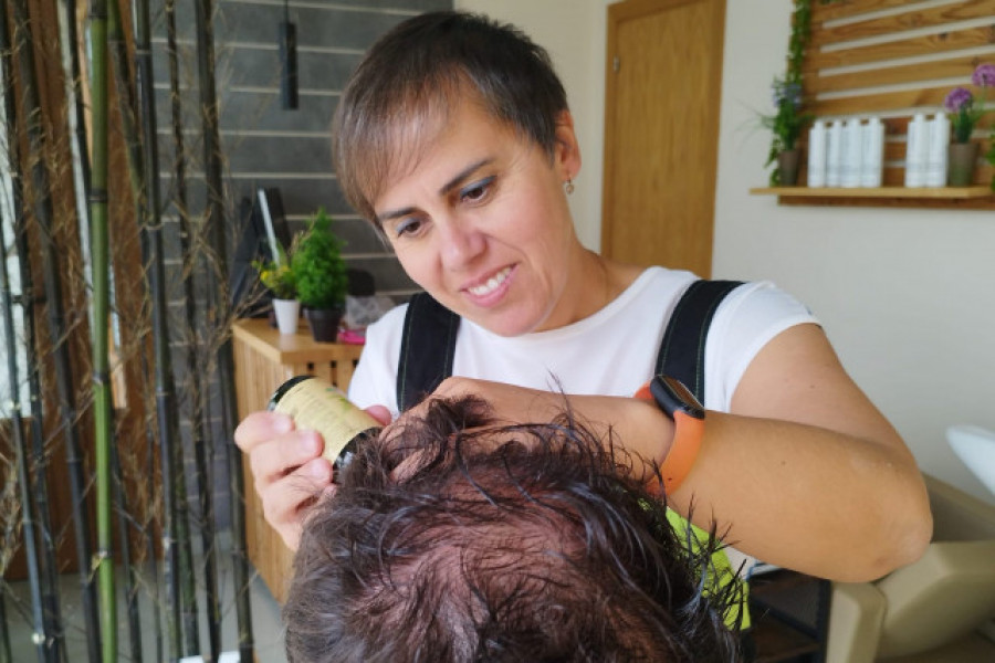 La crioterapia capilar ayuda a recuperar la pérdida del cabello